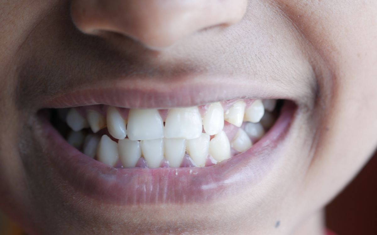 Close-up image of a person's smile highlighting teeth and lips, vibrant and cheerful.