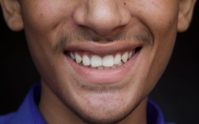 A detailed close-up of a young man's smile showcasing dental health and happiness.