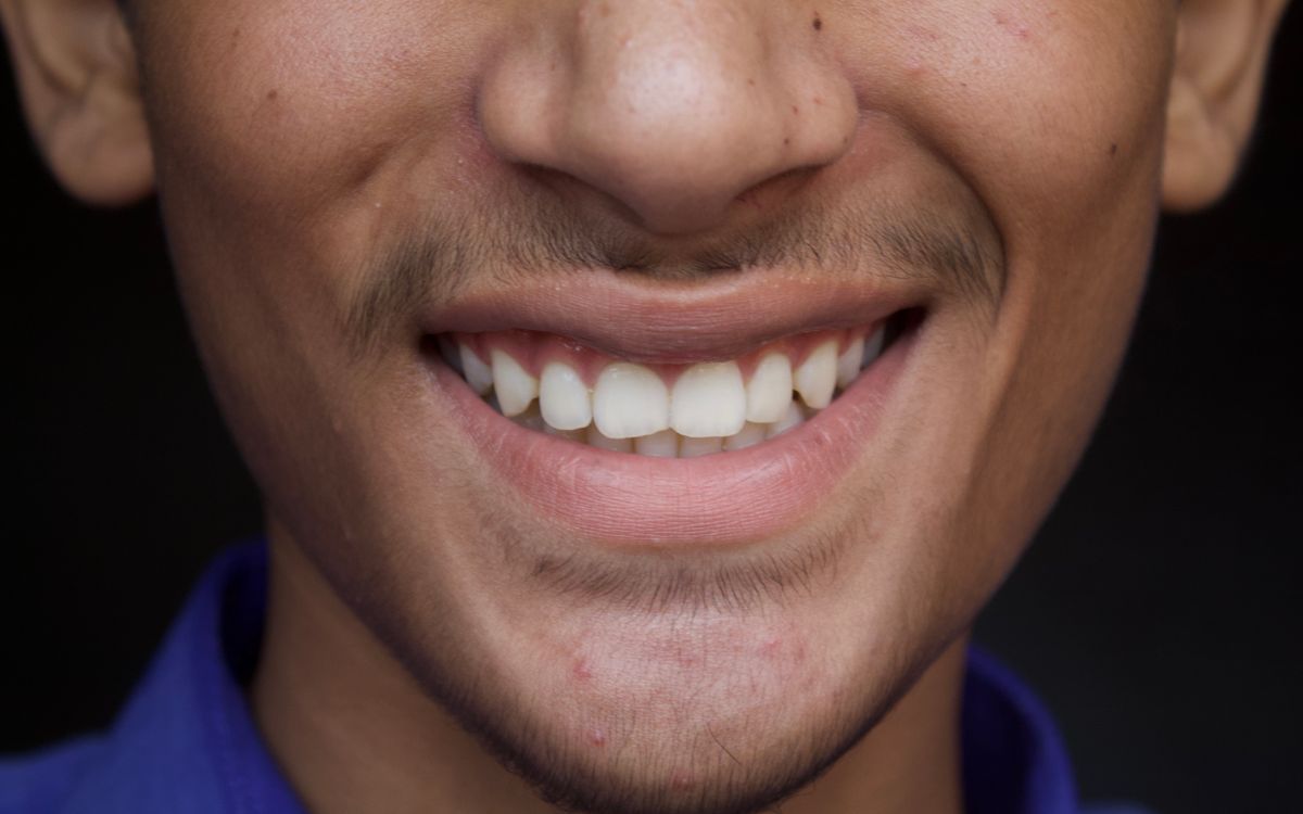 A detailed close-up of a young man's smile showcasing dental health and happiness.
