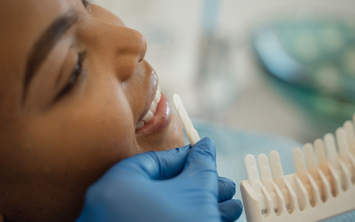 Smiling woman receiving a dental checkup with shade guide in the clinic.