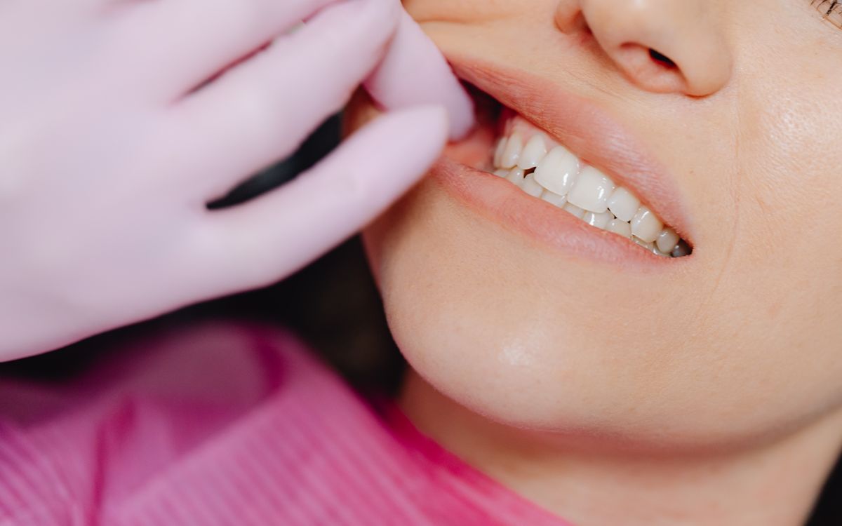 A dentist's gloved hand inspecting a patient's teeth during a check-up.