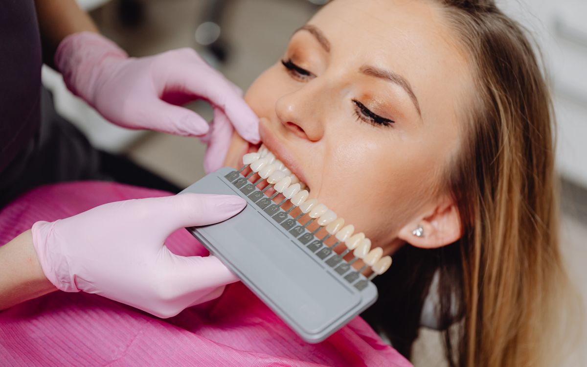 Dental shade guide being used to match tooth color during a hygiene procedure.