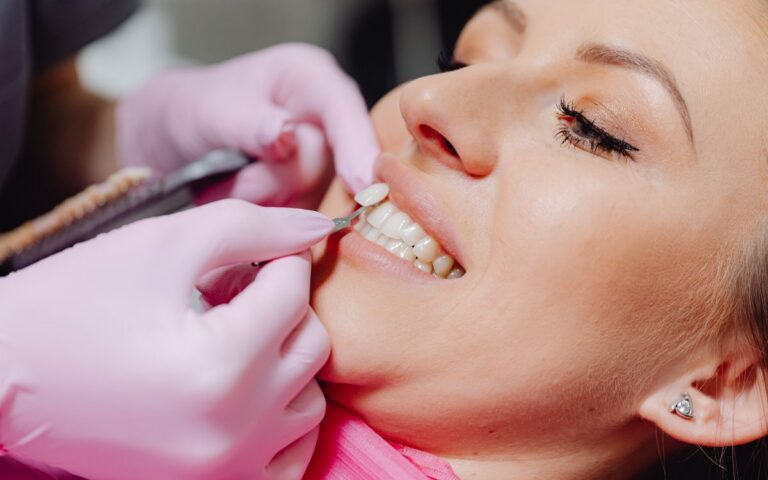 A close-up of a woman receiving dental veneers, showcasing detail and precision.
