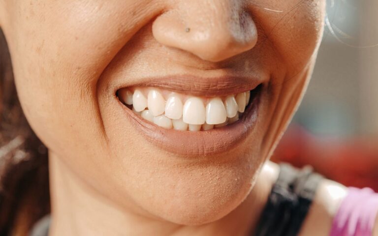 A close-up of a woman's smile, showcasing healthy teeth and natural skin tone.