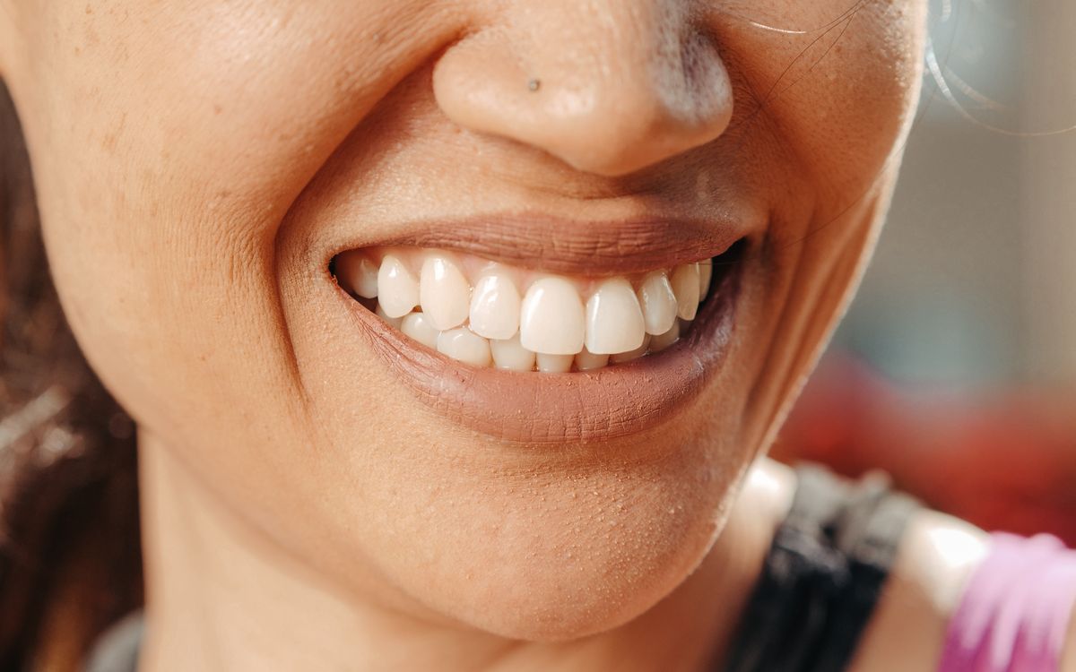 A close-up of a woman's smile, showcasing healthy teeth and natural skin tone.