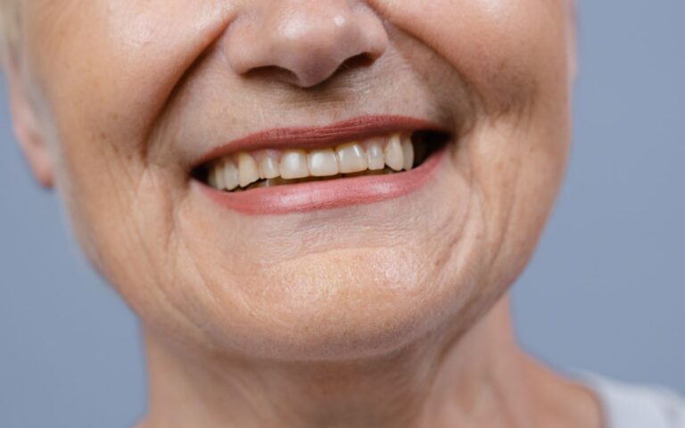 A detailed close-up of a senior woman's smile showcasing her natural teeth and wrinkles.