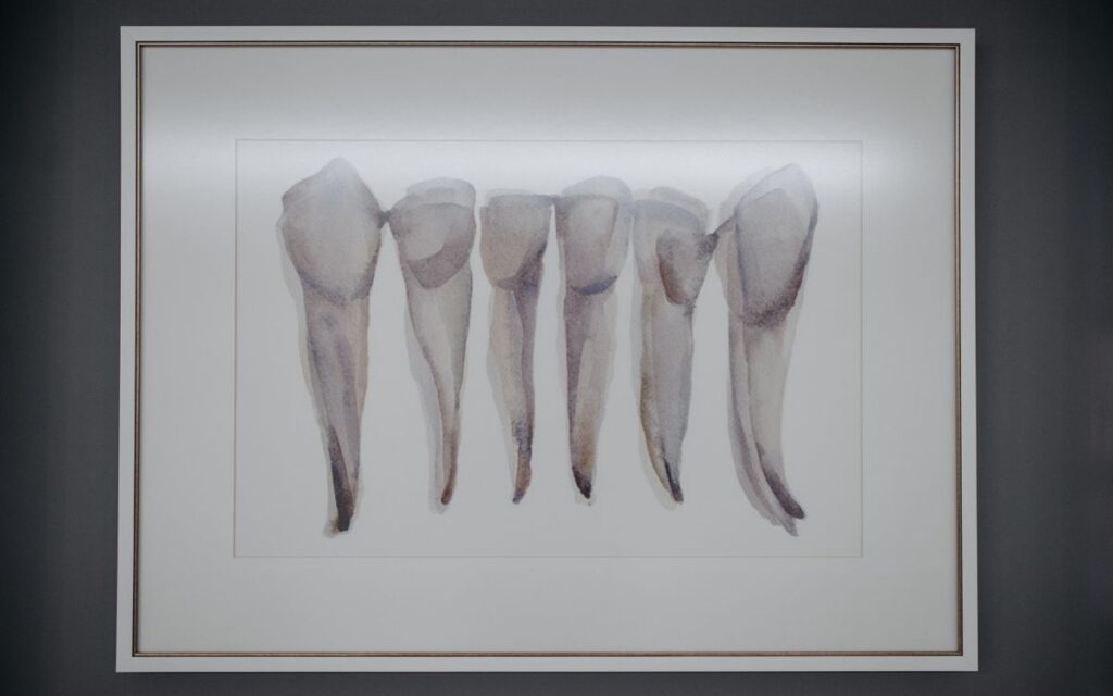 Artistic depiction of extracted teeth framed and displayed in a dental clinic.