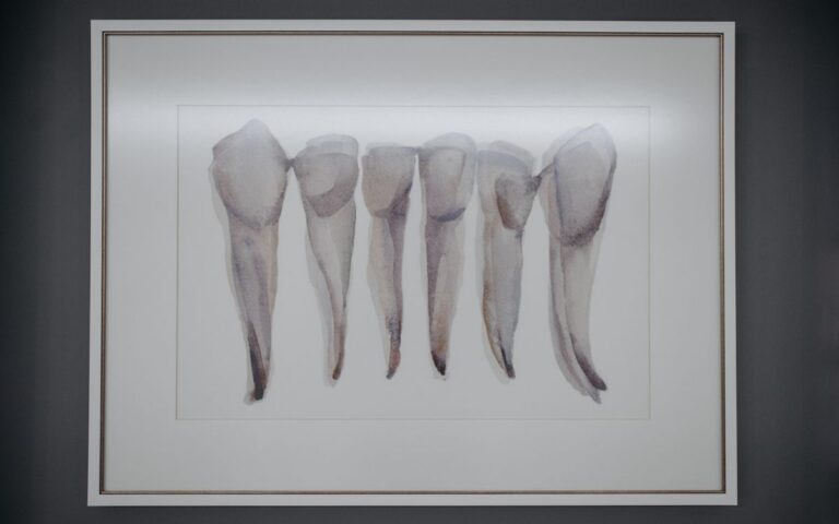 Artistic depiction of extracted teeth framed and displayed in a dental clinic.