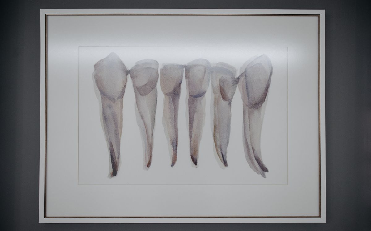 Artistic depiction of extracted teeth framed and displayed in a dental clinic.